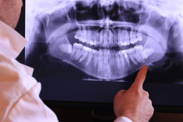 Best Urgent Care for Lost Fillings or Crowns in Fairlea, WV