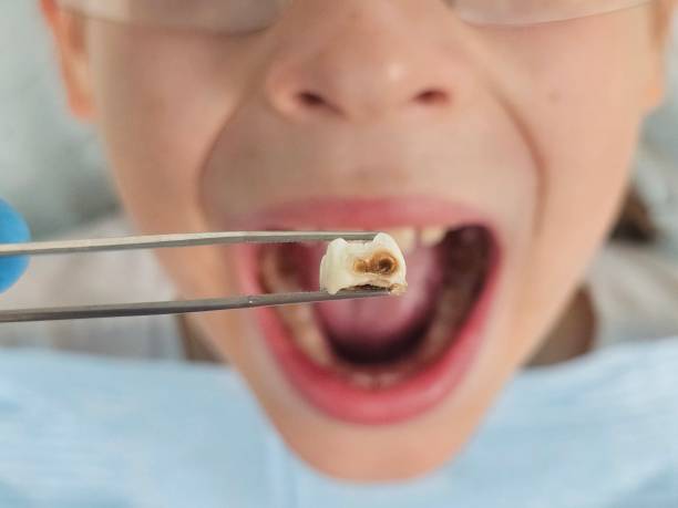Best Same-Day Emergency Dental Services in Fairlea, WV